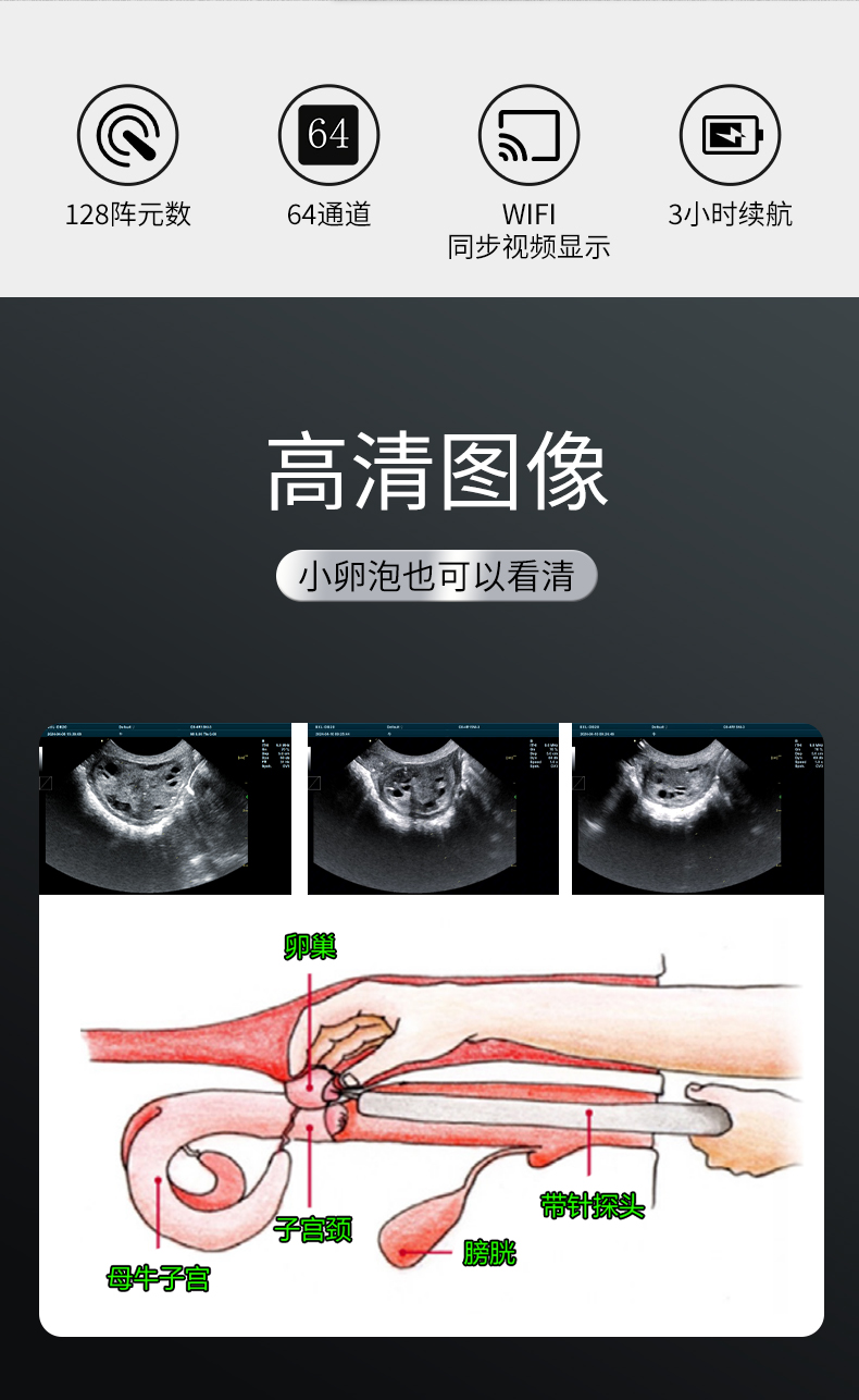 牛马OPU采卵B超机